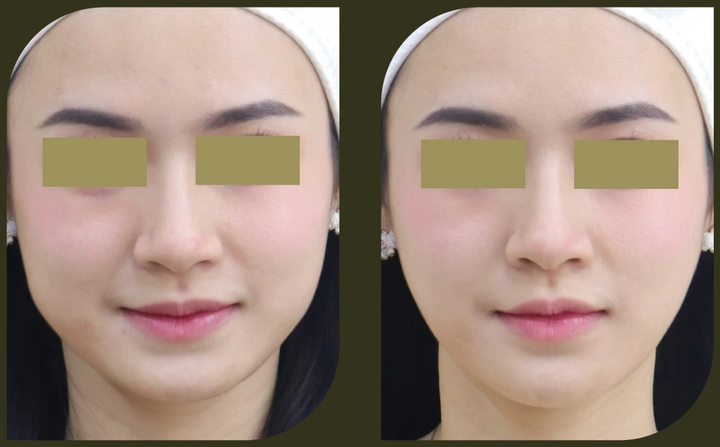 逆齡定妝術 Femio