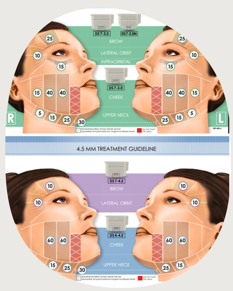 Ultherapy