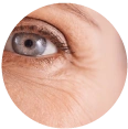 Ultherapy