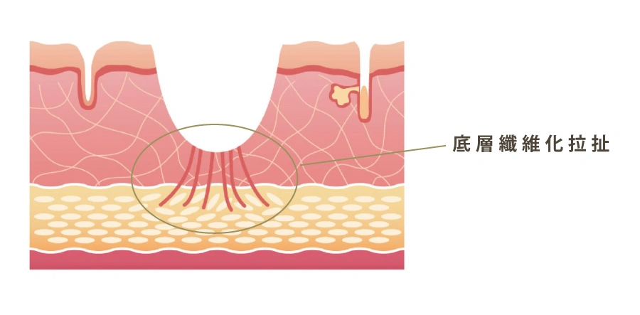 平瑕修復綜合方案| Femio