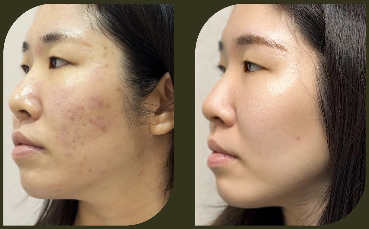 平瑕修復綜合方案| Femio